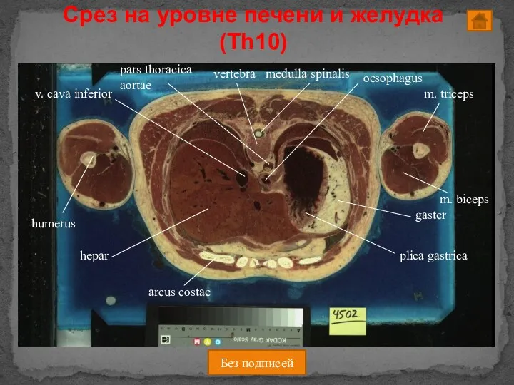 Срез на уровне печени и желудка (Th10) Без подписей