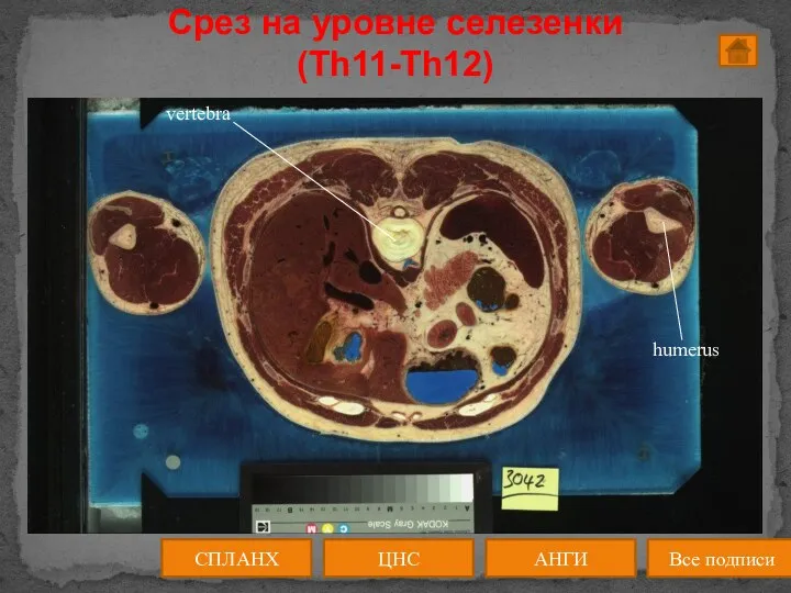 АНГИ СПЛАНХ Все подписи ЦНС Срез на уровне селезенки (Th11-Th12)