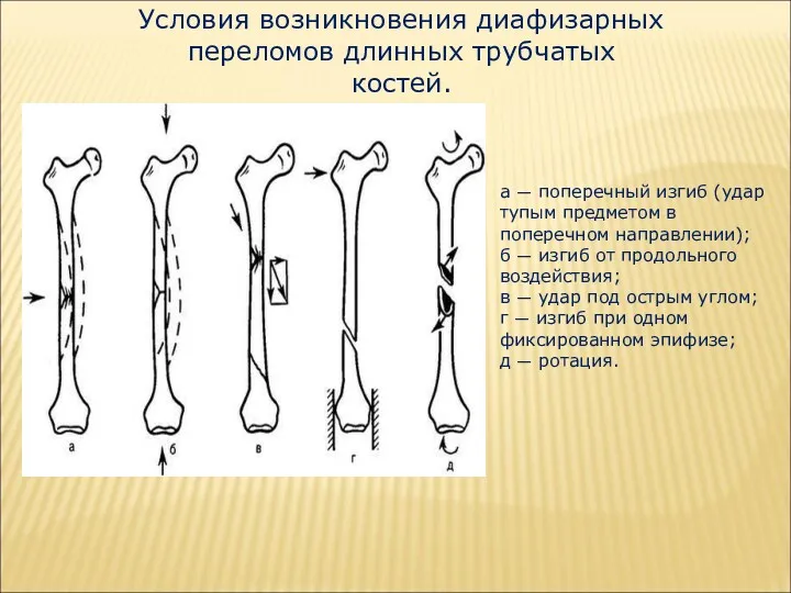 а — поперечный изгиб (удар тупым предметом в поперечном направлении);