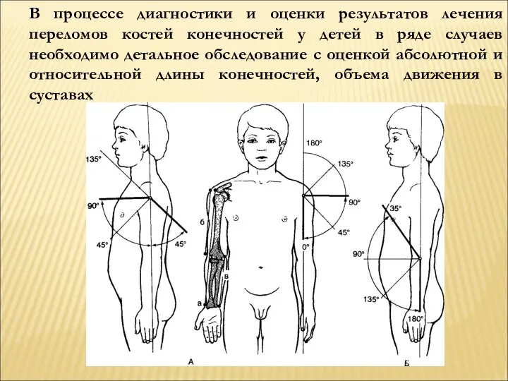 В процессе диагностики и оценки результатов лечения переломов костей конечностей