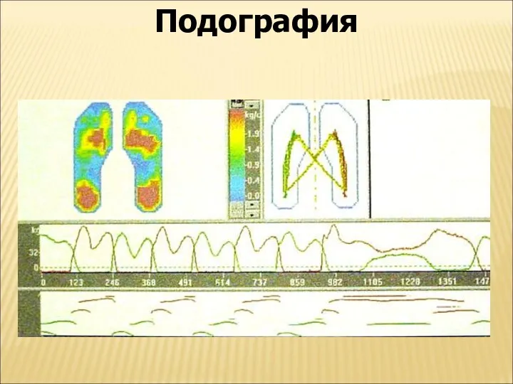 Подография