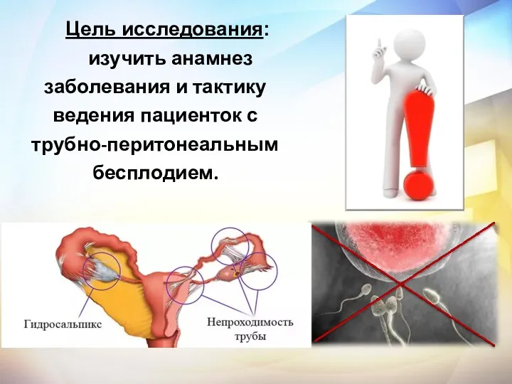 Цель исследования: изучить анамнез заболевания и тактику ведения пациенток с трубно-перитонеальным бесплодием.