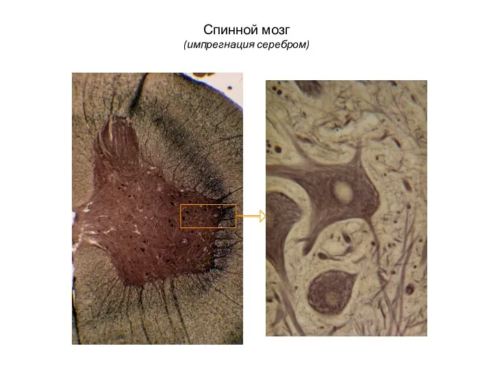 Спинной мозг (импрегнация серебром)