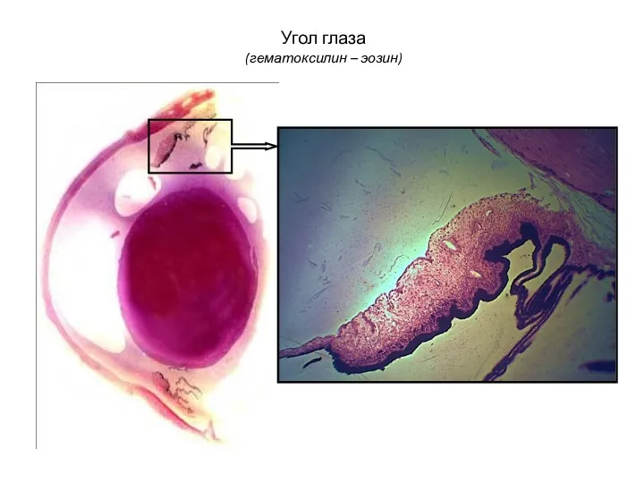 Угол глаза (гематоксилин – эозин)