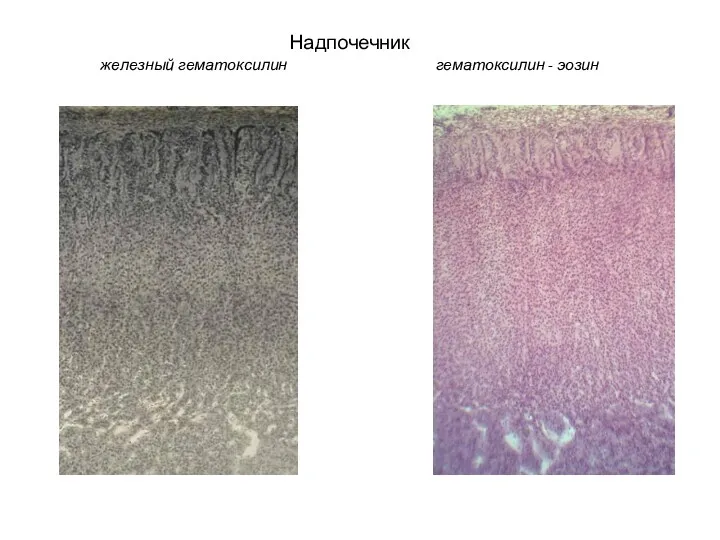Надпочечник железный гематоксилин гематоксилин - эозин