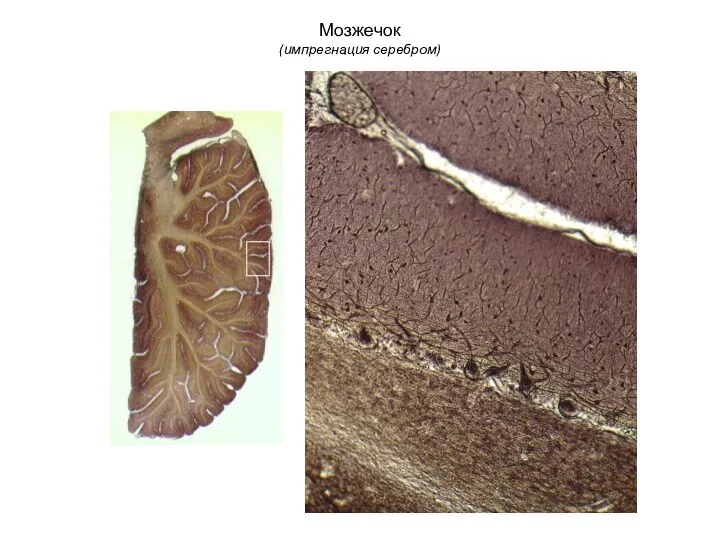 Мозжечок (импрегнация серебром)