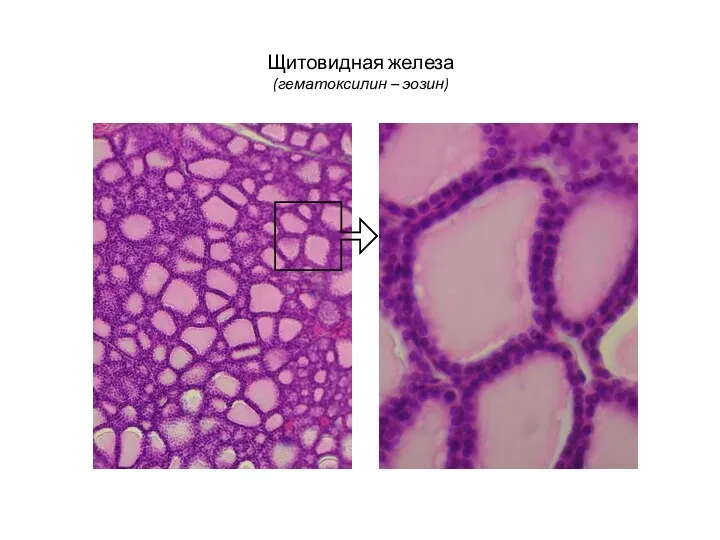 Щитовидная железа (гематоксилин – эозин)