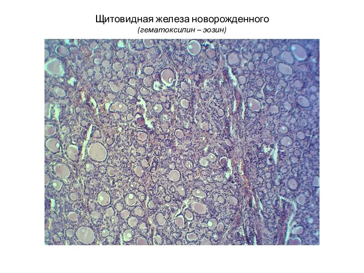 Щитовидная железа новорожденного (гематоксилин – эозин)