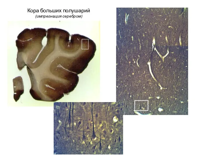 Кора больших полушарий (импрегнация серебром)