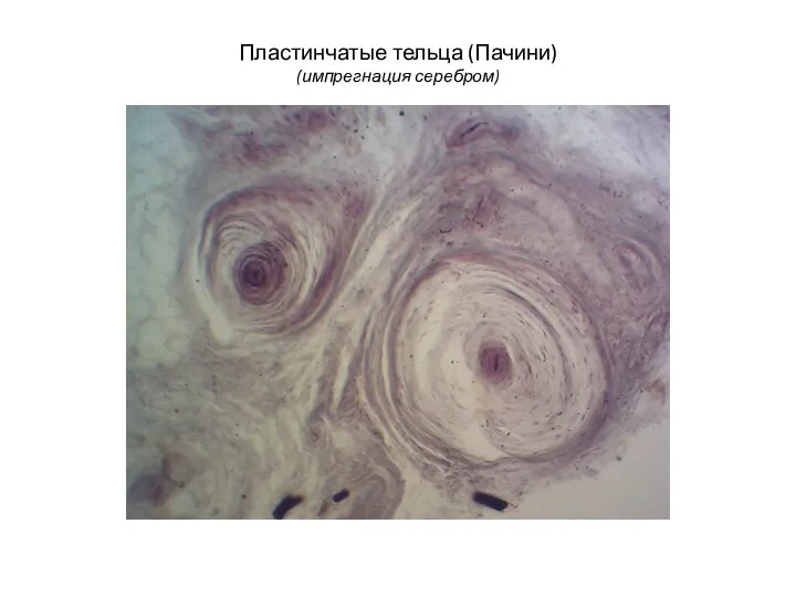 Пластинчатые тельца (Пачини) (импрегнация серебром)