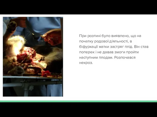 При розтині було виявлено, що на початку родової діяльності, в