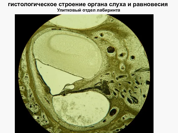 гистологическое строение органа слуха и равновесия Улитковый отдел лабиринта
