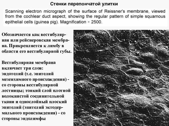 Стенки перепончатой улитки Верхнемедиальная стенка Обозначается как вестибуляр-ная или рейснеровская