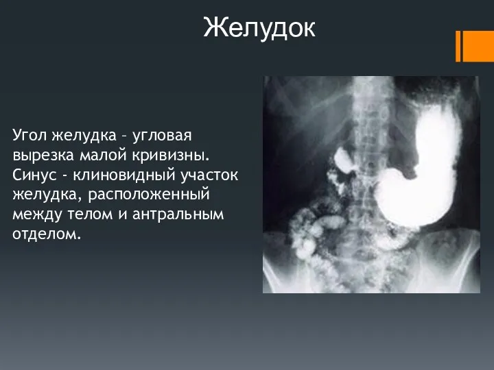 Желудок Угол желудка – угловая вырезка малой кривизны. Синус - клиновидный участок желудка,