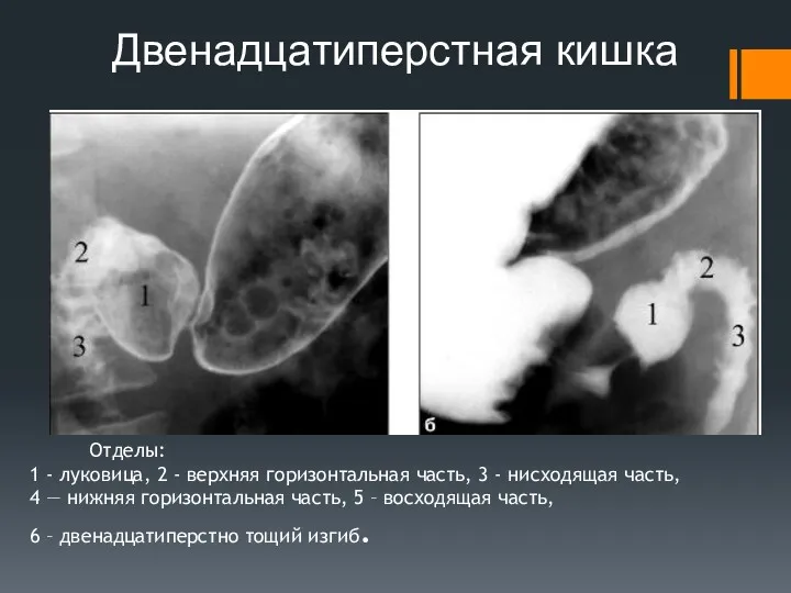 Двенадцатиперстная кишка Отделы: 1 - луковица, 2 - верхняя горизонтальная часть, 3 -