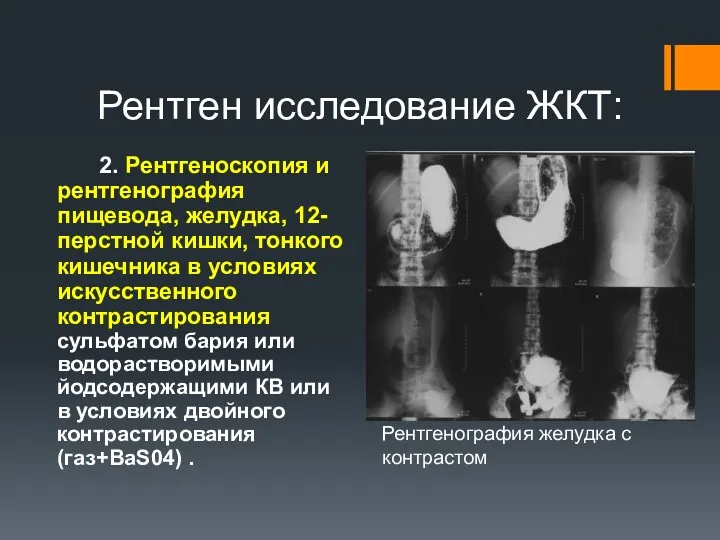 Рентген исследование ЖКТ: 2. Рентгеноскопия и рентгенография пищевода, желудка, 12-перстной