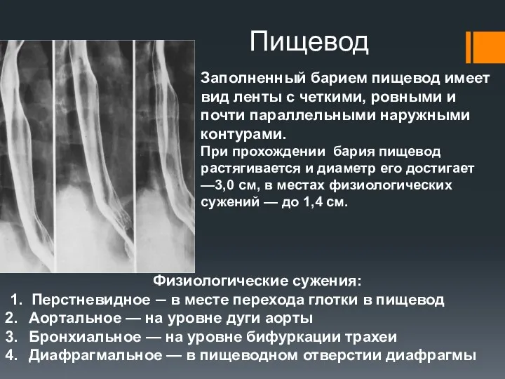 Пищевод Заполненный барием пищевод имеет вид ленты с четкими, ровными