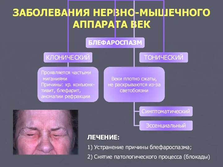 ЗАБОЛЕВАНИЯ НЕРВНО-МЫШЕЧНОГО АППАРАТА ВЕК ЛЕЧЕНИЕ: 1) Устранение причины блефароспазма; 2) Снятие патологического процесса (блокады)