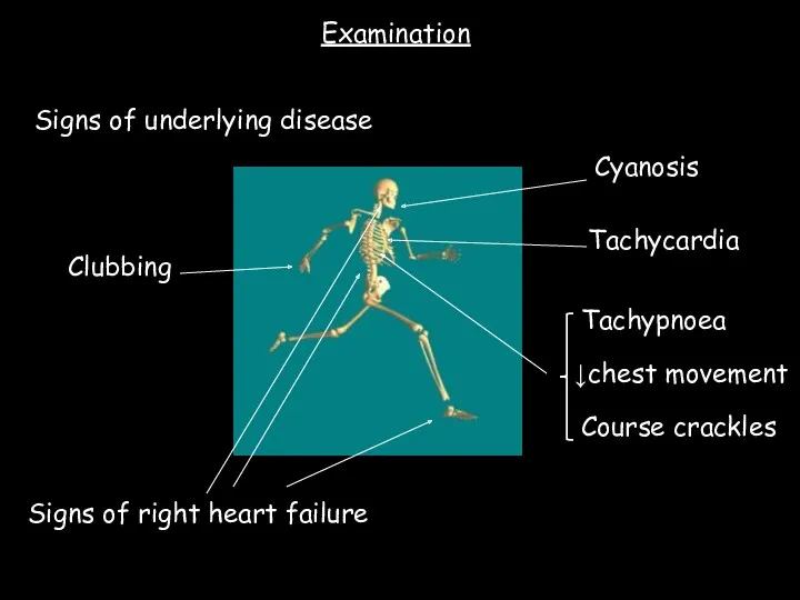 Clubbing Course crackles Tachypnoea Signs of right heart failure Signs