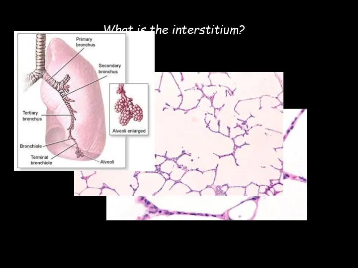 What is the interstitium?