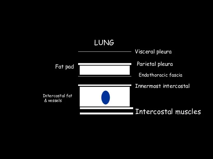 Visceral pleura Parietal pleura Fat pad Endothoracic fascia Innermost intercostal