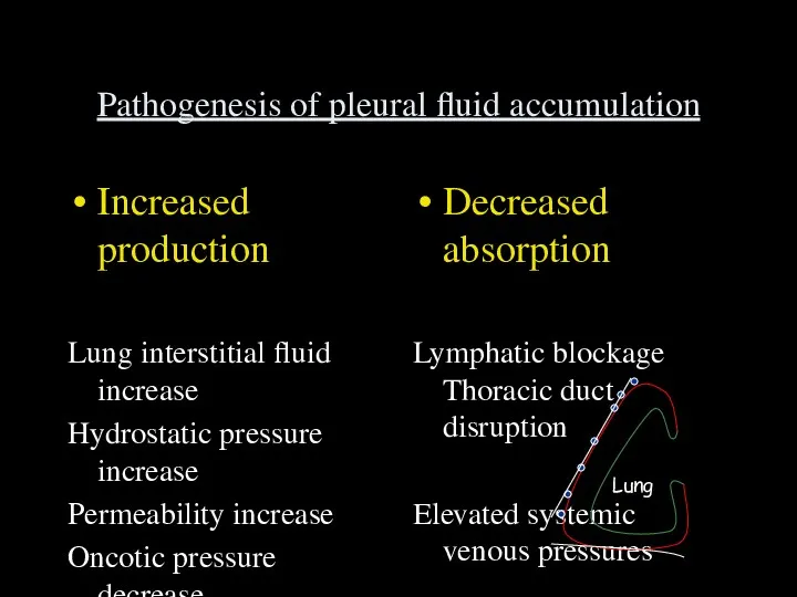 Pathogenesis of pleural fluid accumulation Increased production Lung interstitial fluid