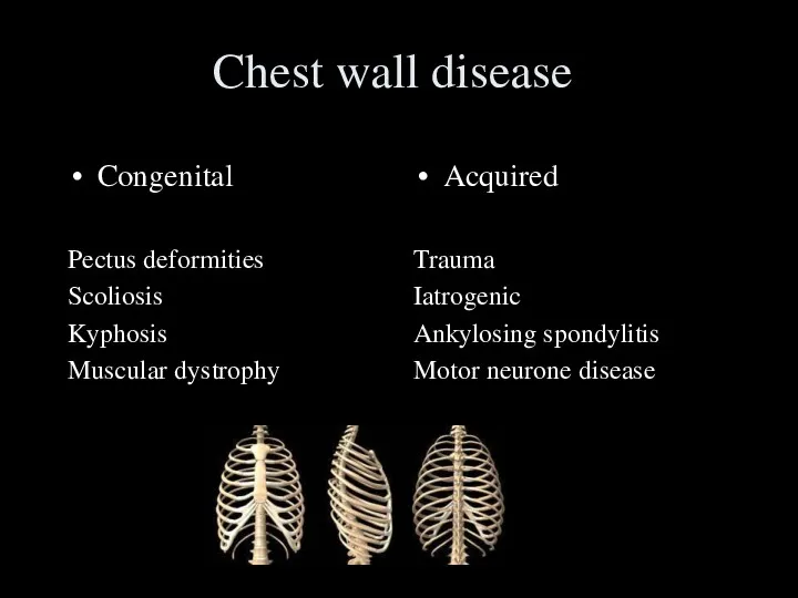 Chest wall disease Congenital Pectus deformities Scoliosis Kyphosis Muscular dystrophy