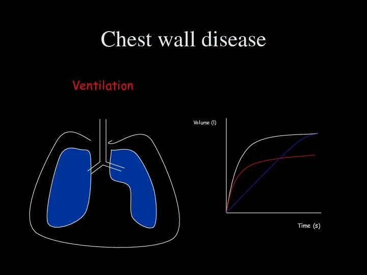 Chest wall disease Ventilation Volume (l) Time (s)