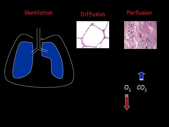 Ventilation Diffusion Perfusion O2 CO2