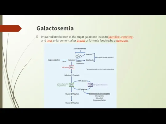 Galactosemia Impaired breakdown of the sugar galactose leads to jaundice,