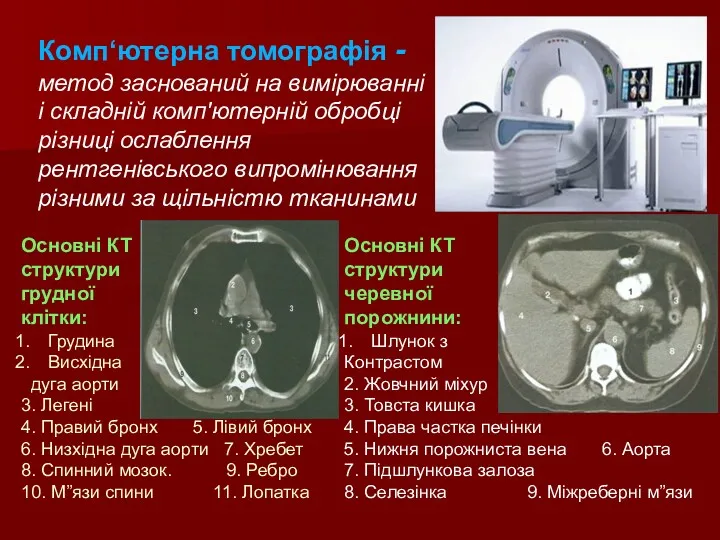 Комп‘ютерна томографія - метод заснований на вимірюванні і складній комп'ютерній