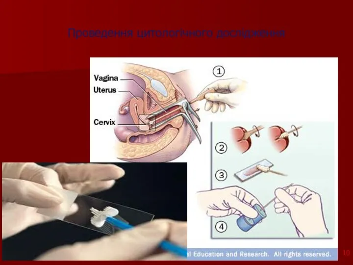 Проведення цитологічного дослідження 5/15/2014 copyright (your organization) 2003