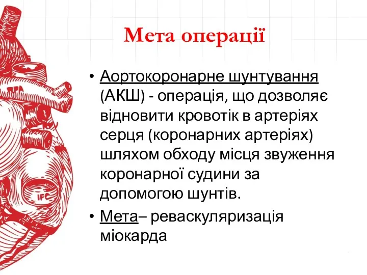 Мета операції Аортокоронарне шунтування (АКШ) - операція, що дозволяє відновити кровотік в артеріях