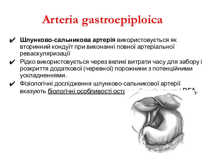 Arteria gastroepiploica Шлунково-сальникова артерія використовується як вторинний кондуїт при виконанні повної артеріальної реваскуляризації