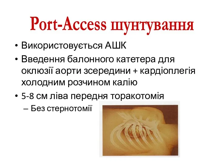 Використовується АШК Введення балонного катетера для оклюзії аорти зсередини + кардіоплегія холодним розчином