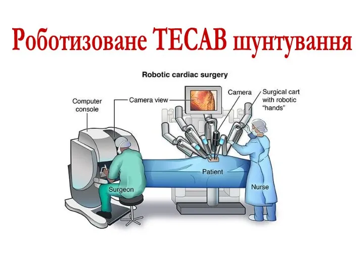 Роботизоване TECAB шунтування