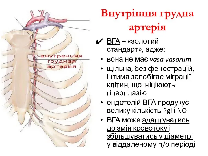 Внутрішня грудна артерія ВГА – «золотий стандарт», адже: вона не має vasa vasorum