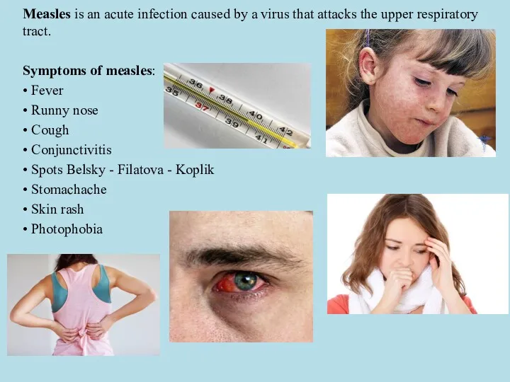 Measles is an acute infection caused by a virus that