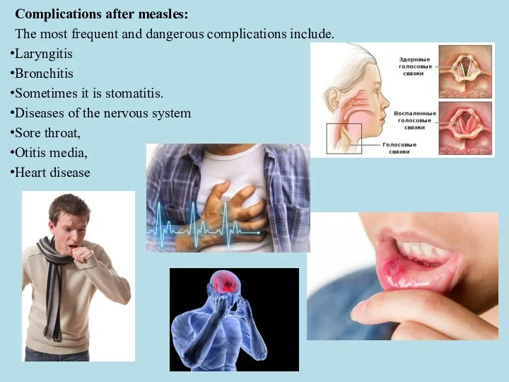 Complications after measles: The most frequent and dangerous complications include.
