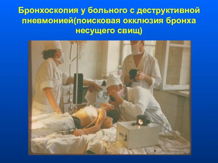Бронхоскопия у больного с деструктивной пневмонией(поисковая окклюзия бронха несущего свищ)