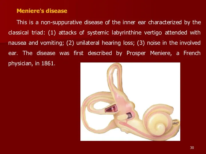 Meniere's disease This is a non-suppurative disease of the inner ear characterized by