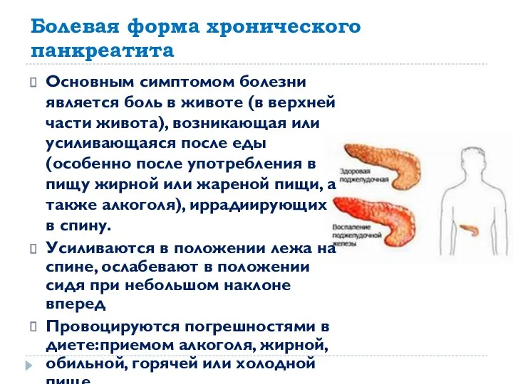 Болевая форма хронического панкреатита Основным симптомом болезни является боль в