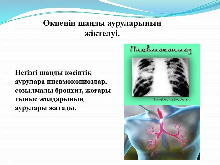 Өкпенің шаңды ауруларының жіктелуі. Негізгі шаңды кәсіптік аурулара пневмокониоздар, созылмалы бронхит, жоғары тыныс жолдарының аурулары жатады.