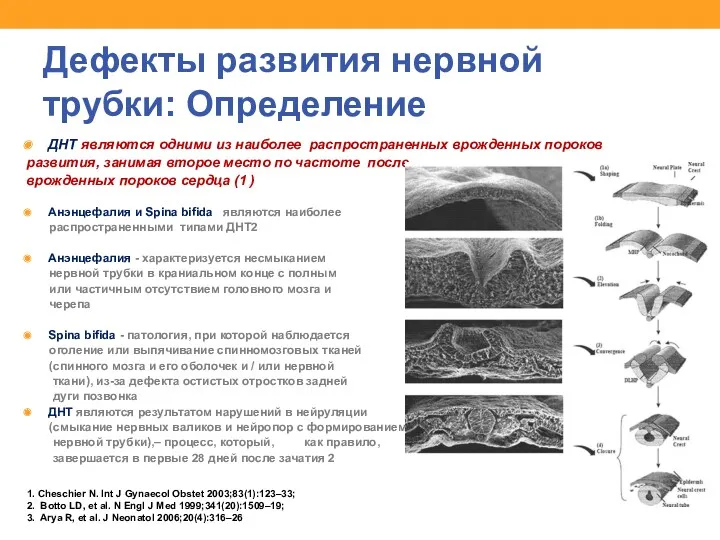 Дефекты развития нервной трубки: Определение ДНТ являются одними из наиболее