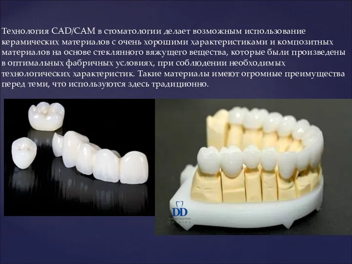 Технология CAD/CAM в стоматологии делает возможным использование керамических материалов с
