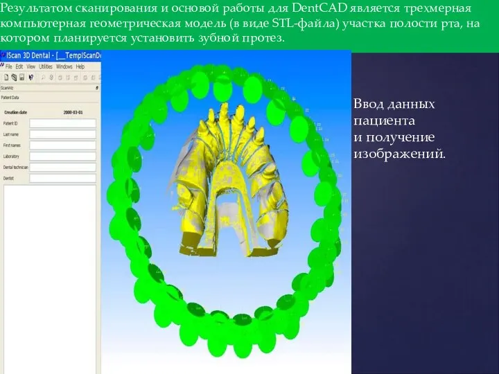 Результатом сканирования и основой работы для DentCAD является трехмерная компьютерная