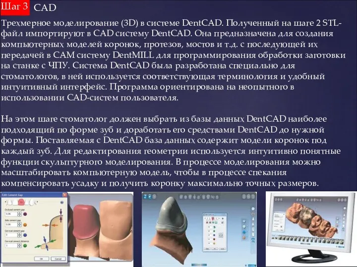 CAD. Шаг 3 Трехмерное моделирование (3D) в системе DentCAD. Полученный