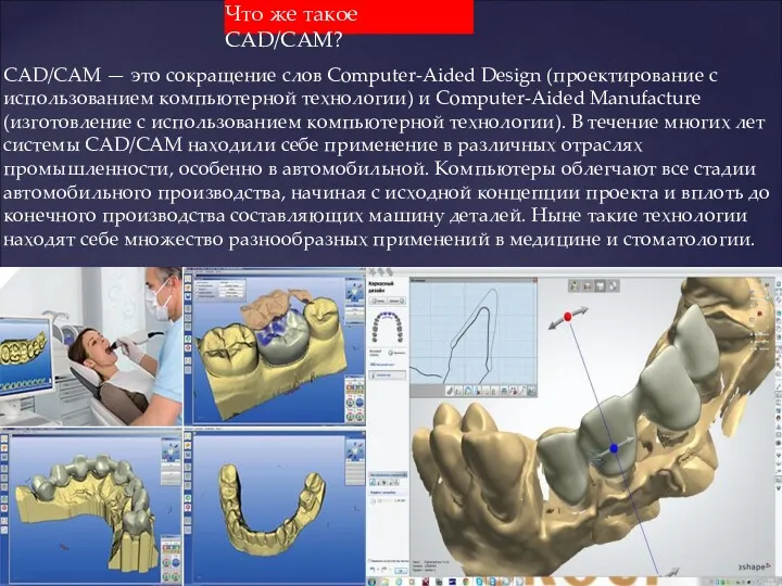 Что же такое CAD/CAM? CAD/CAM — это сокращение слов Computer-Aided