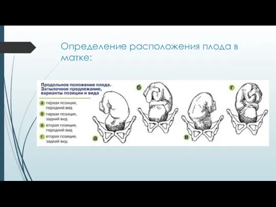 Определение расположения плода в матке: