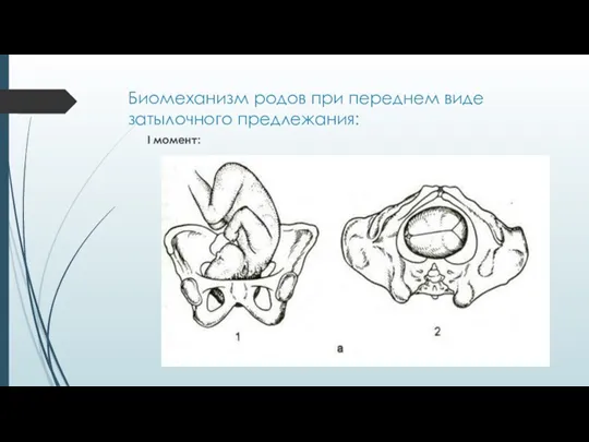 Биомеханизм родов при переднем виде затылочного предлежания: I момент: